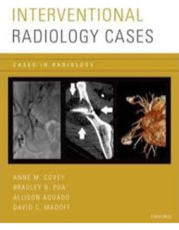 Interventional Radiology Cases